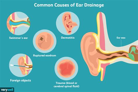 ear leaking clear fluid no pain|Ear Drainage: Causes and Treatment